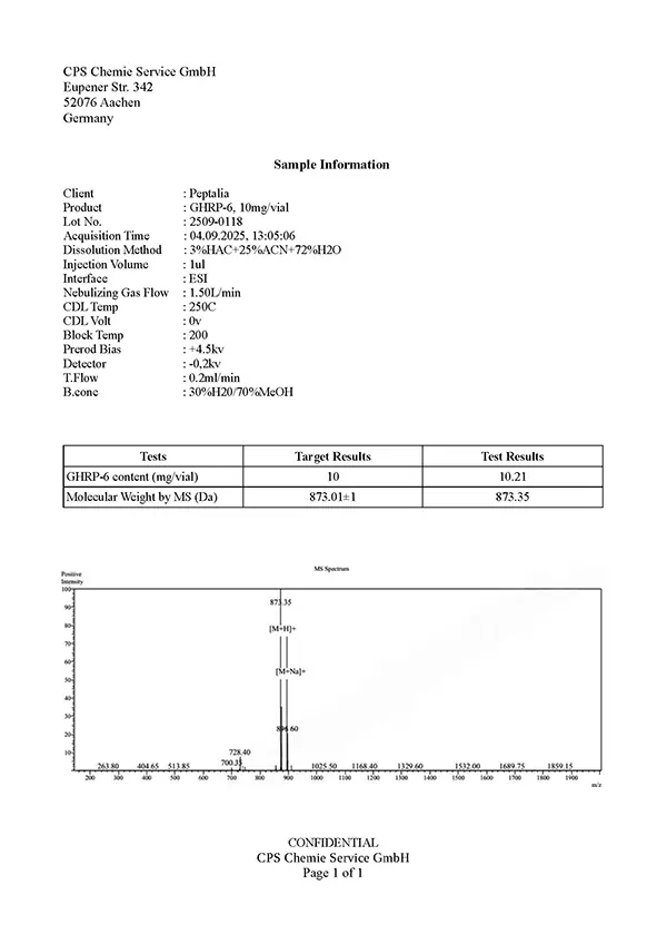 Espectrometría de masas