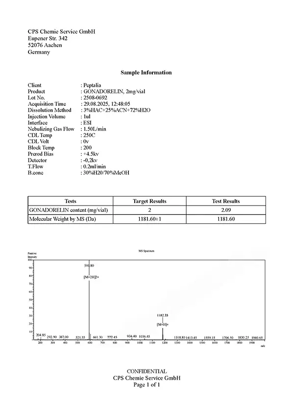Espectrometría de masas
